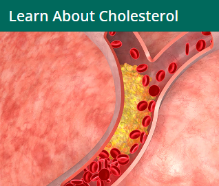 HEALTH & YOUR FITNESS. A photo showing blood flow in a blood vessel being impeded by Cholesterol